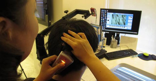 广州哪个种植头发医院种植头发手术比较好？