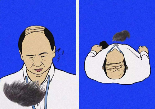 种植头发常见问题