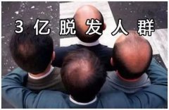 种植头发的费用在广州大概多少钱